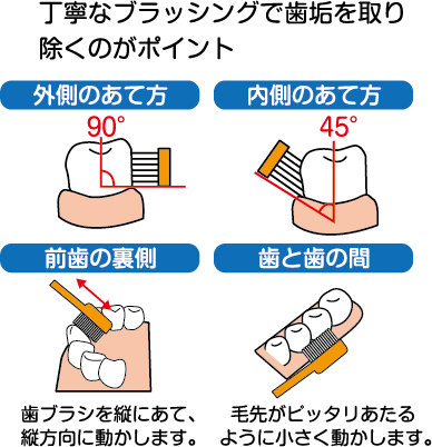 元気なお口を保つために！丁寧なブラッシングで歯垢を取り除くのがポイント